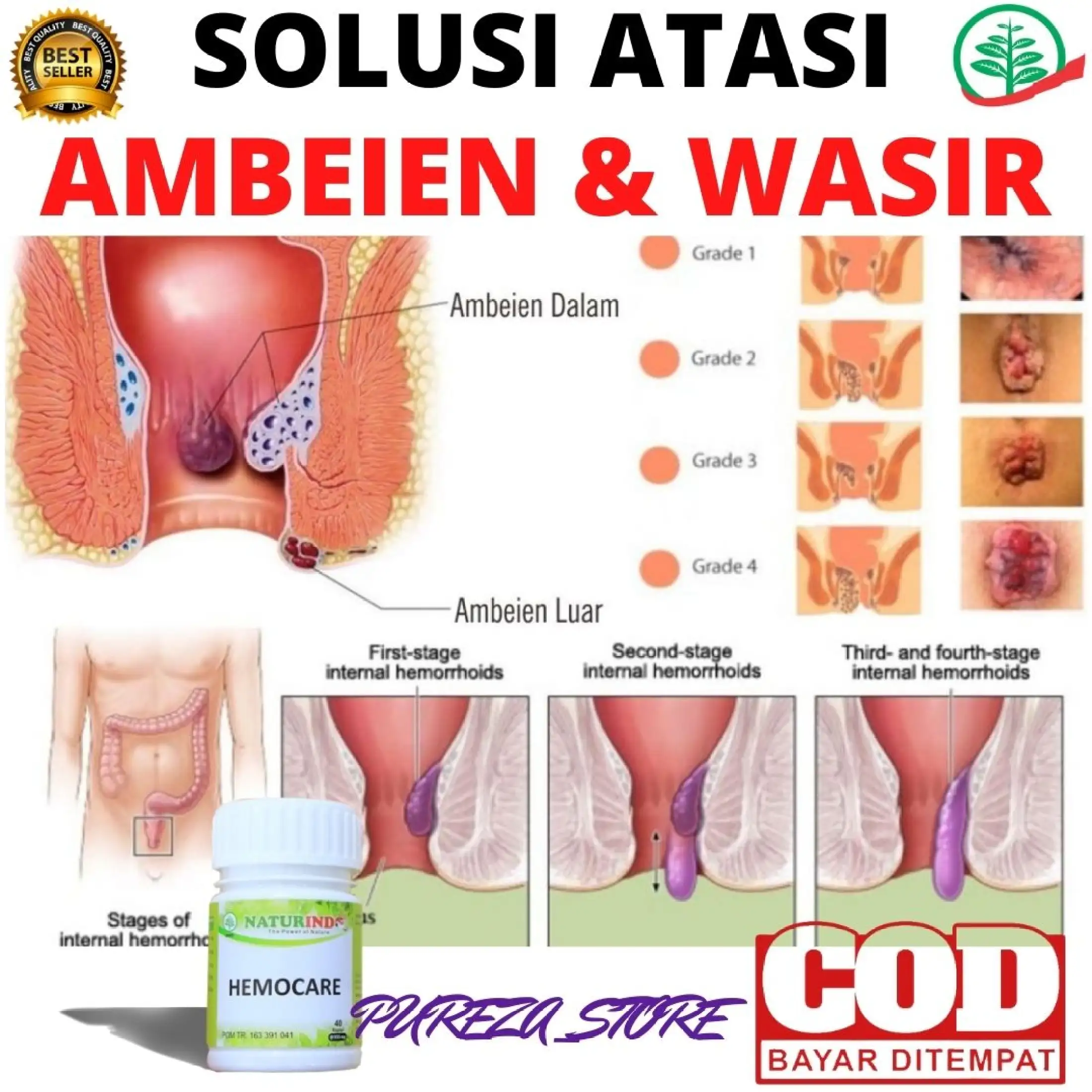 Obat Ambeien Wasir Stadium 1 4 Paling Ampuh Obat Wasir Luar Dalam Obat Wasir Berdarah Kapsul Extra Daun Ungu Herbal Alami Naturindo Lazada Indonesia