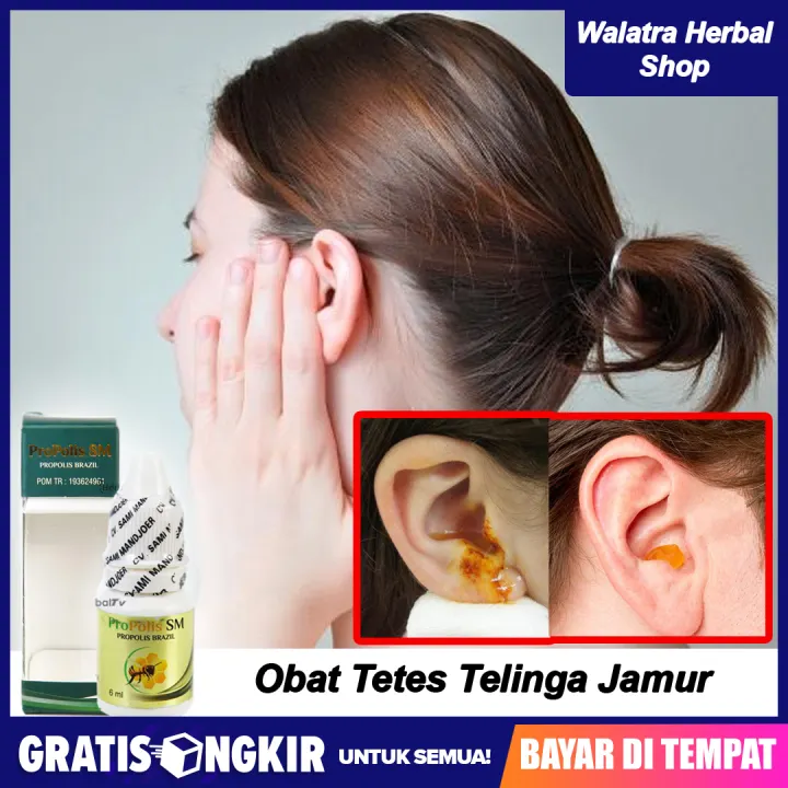 Obat Tetes Telinga Jamur Kemasukan Air Tersumbat Gatal Dan Berair Berdengung Terus Menerus Propolis Sm Lazada Indonesia