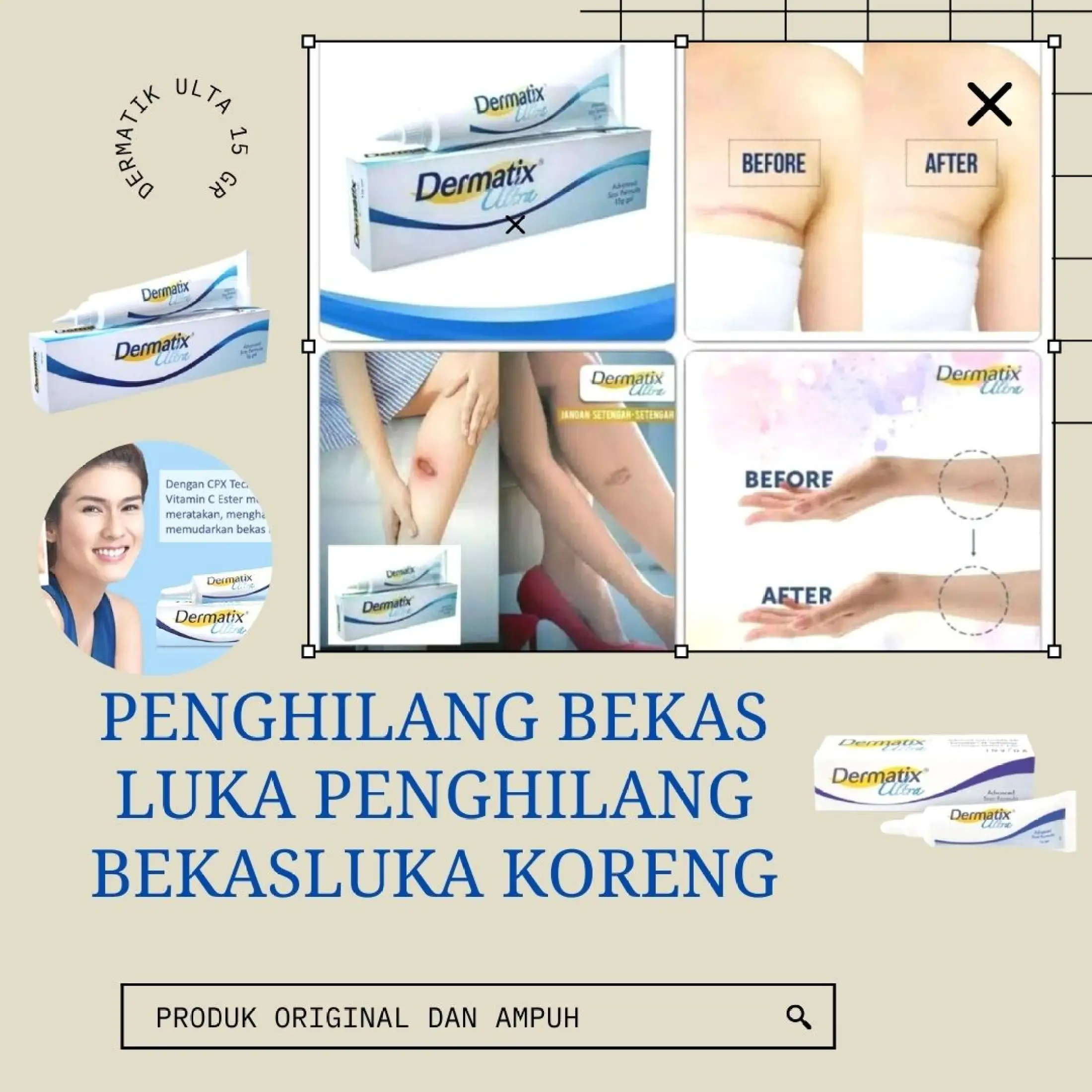 Dermatix Penghilang Bekas Luka Krim Penghilang Bekas Gatal Yang Menghitam Salep Penghilang Bekas Luka Hitam Cream Penghilang Bekas Gatal Obat Penghilang Bekas Komedo Penghilang Bekas Jerawat Dan Bopeng Salep Penghilang Bekas<script async src=