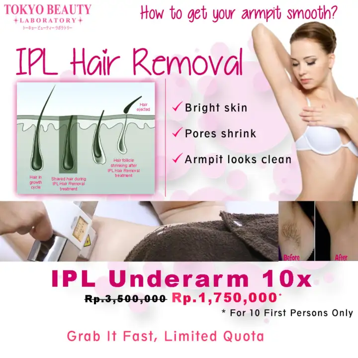 Ipl Hair Removal Underarm 10x Lazada Indonesia