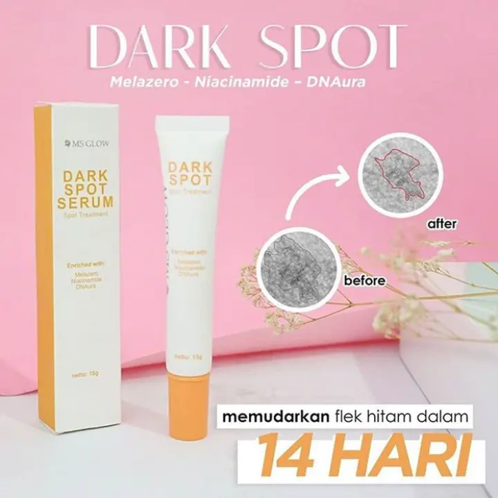 Ms Glow Spot Treatment Dark Spot Perawatan Flek Dark Spot Treatment Lazada Indonesia