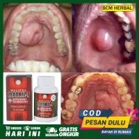 Jual Obat Tumor Jinak Rongga Mulut Terbaru Lazada Co Id