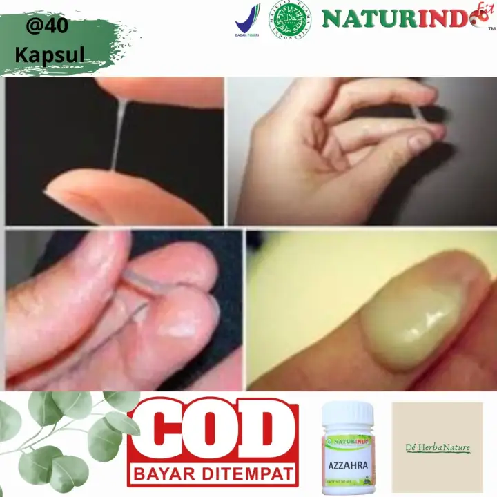 Obat Keputihan Parah Keputihan Wanita Gatel Gatal Miss V Bagina Herbal Alami Keputian Wanita Gatal Parah