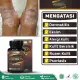 Obat Dermatitis Seboroik, Dermatitis Atopik, Dermatitis Kontak, Dermatitis Perioral, Dermatitis Numularis, Dermatitis Kepala, Eksim, Alergi Kulit, Ruam Kulit, Ketombe Berkerak Di Kepala, Kulit Bersisik, Psoriasis - Sehat Kulit Proskin Asli Bergaransi. 
