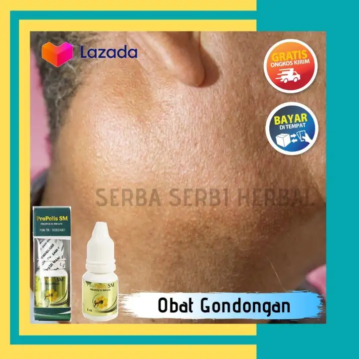 Muncul Benjolan Di Daun Telinga Apakah Perlu Merasa Cemas