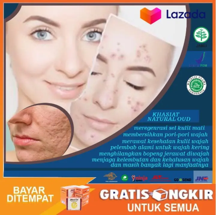 Natural Oud 100 Original Sabun Wajah Penghilang Milia Sabun Pencuci Muka Penghilang Milia Mengobati Berbagai Jenis Jerawat Penghancur Milia Sabun Pembersih Bintik Putih Natural Oud Lazada Indonesia