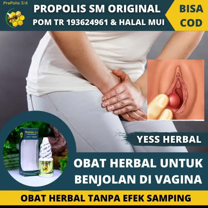 Obat Herbal Untuk Benjolan Di Bibir Vagina Daging Menonjol Di Kewanitaan Bengkak Gatal Perih Pada Kelamin Kutil Polip Rahim Kista Ovarium Dan Bartholin Tumor Cara Menghilangkan Bentol Di Miss V Penghilang Skin