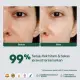 NPURE Dark Spot Cica / Brightening Spot Treatment / Bekas Jerawat / Flek Hitam. 