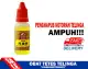 Obat Tetes Kotoran Telinga Keras - Cairan Pembersih Telinga / Penghancur Kotoran - Obat Telinga Curek Berair dan Bau - Obat Tetes Telinga Alami Berkhasiat Herbal - Jingduertongye Pembersih Kotoran Telinga Herbal Tinnitus Tuli. 
