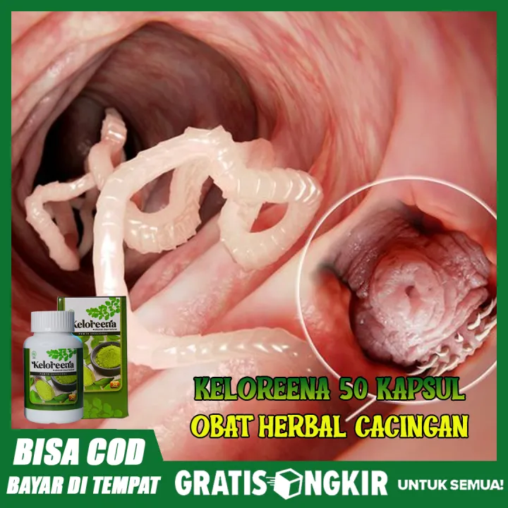 Obat Herbal Cacingan Obat Cacing Di Perut Cacing Kremi Cacing Pita Cacing Gelang Cacing Pipih Cacing Tambang Cacing Trikionsis Cacing Keloreena 50 Kapsul Lazada Indonesia