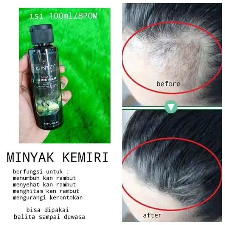 Kuntze Minyak Kemiri Hitam Original Bpom 100 Ml Minyak Kemiri Kuntze Melebatkan Rambut Botak Lazada Indonesia