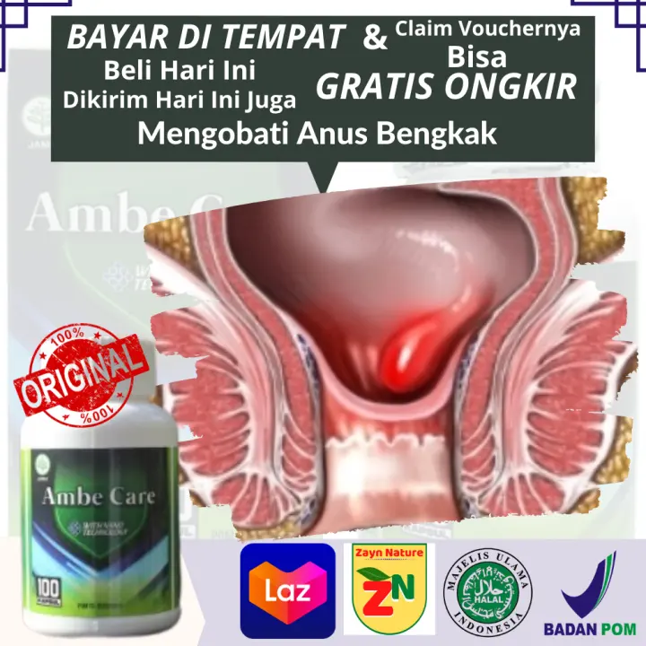 Obat Anus Membengkak Obat Herbal Untuk Mengobati Pembengkakan Vena Di Daerah Dubur Alami Suplemen Buat Mengatasi Obat Anus Membengkak Obat Herbal Untuk Mengobati Pembengkakan Vena Di Daerah Dubur Alami Suplemen Buat Mengatasi
