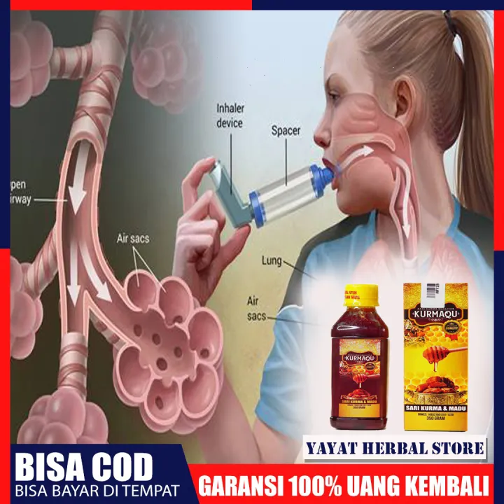 Kurmaqu Obat Asma Obat Sesak Nafas Obat Dada Pengap Obat Nyeri Dada Obat Batuk Berdahak Obat Infeksi Paru Paru Obat Dada Terasa Berat Obat Penyakit Ispa Sari Kurma Dan Madu