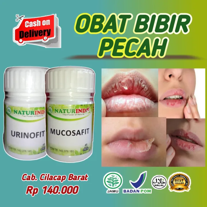 Jual Obat Bibir Pecah Pecah Obat Bibir Berdarah Bibir Kering Bibir Mengelupas Herbal Aman 100 Terpercaya Lazada Indonesia
