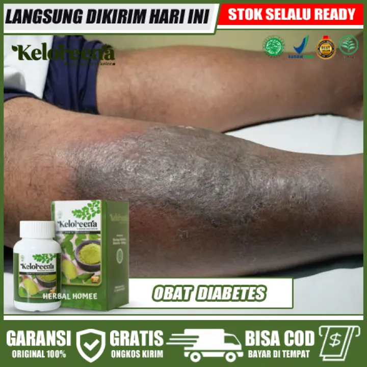 Kencing Tak Lawas Punca Dan Cara Rawatan The Diagnosa