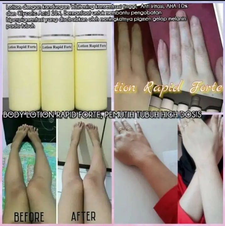 Hand Body Whitening Rapid Lotion Forte Hb Whitening Lotion Forte Pencerah Tubuh Extra White Lazada Indonesia