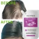 DEVNEN Shampo Anti Rambut Rontok Melembutkan & Menghaluskan Rambut Treatment Shampoo Oil Control Anti Ketombe Shampo Penumbuh Rambut. 