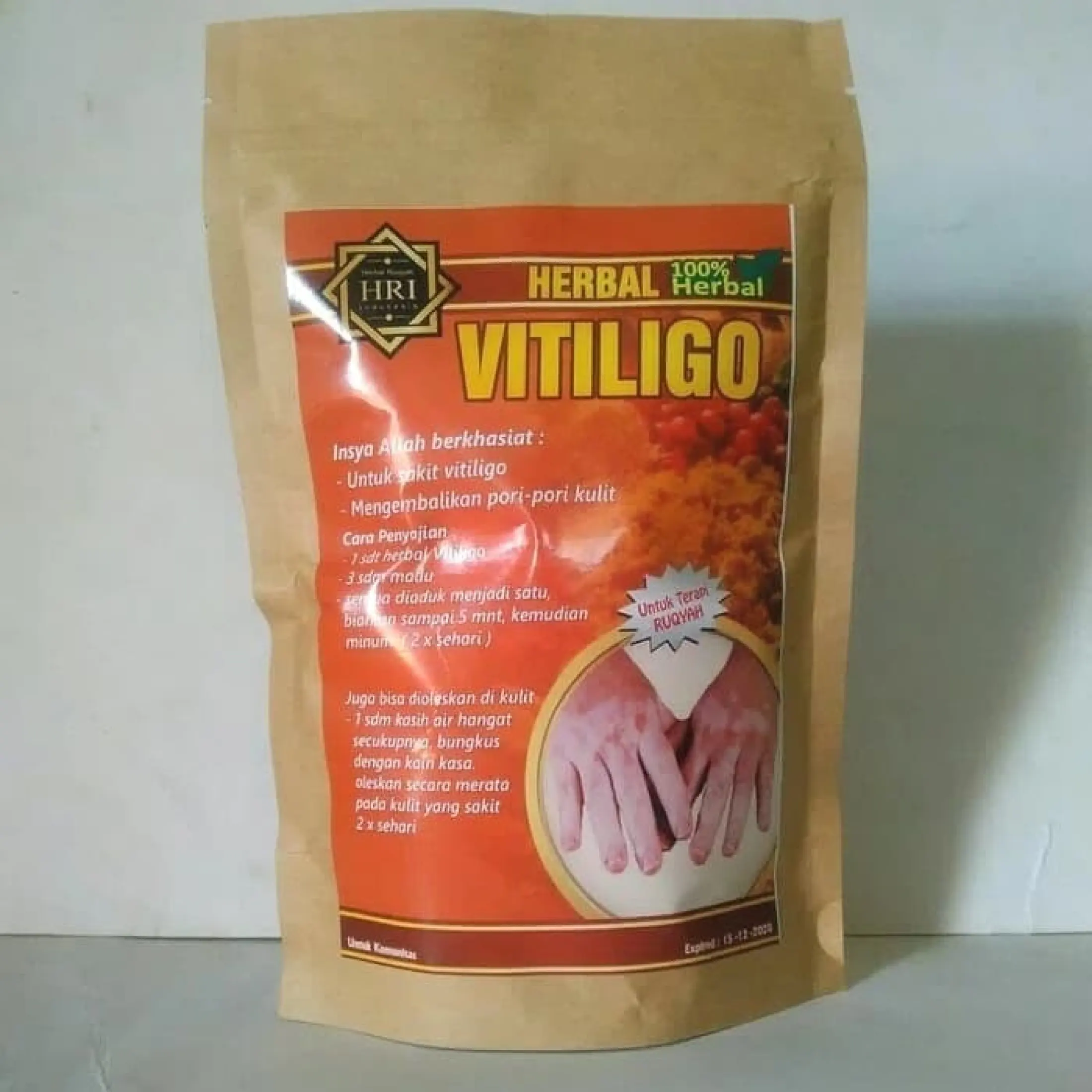 Obat Tradisional Obat Herbal Sakit Vitiligo Mengembalikan Pori Pori Kulit Kulit Bercak Putih Kulit Belang Kult Pudar Lazada Indonesia