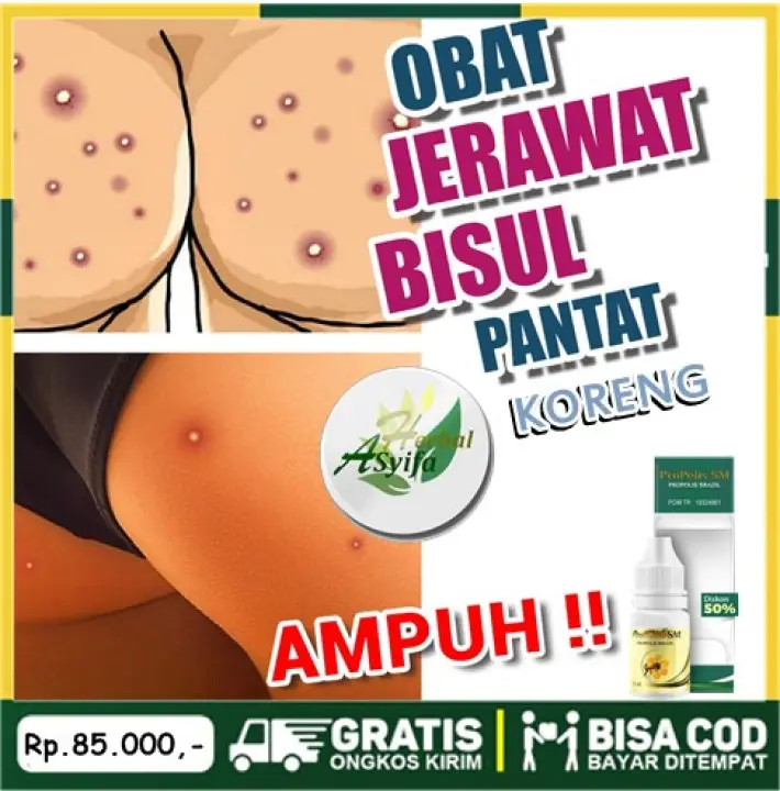 Obat Koreng Di Pantat Herbal Penghilang Gatal Bruntus Bekas Luka Hitam Di Pantat Obat Herbal Cenang
