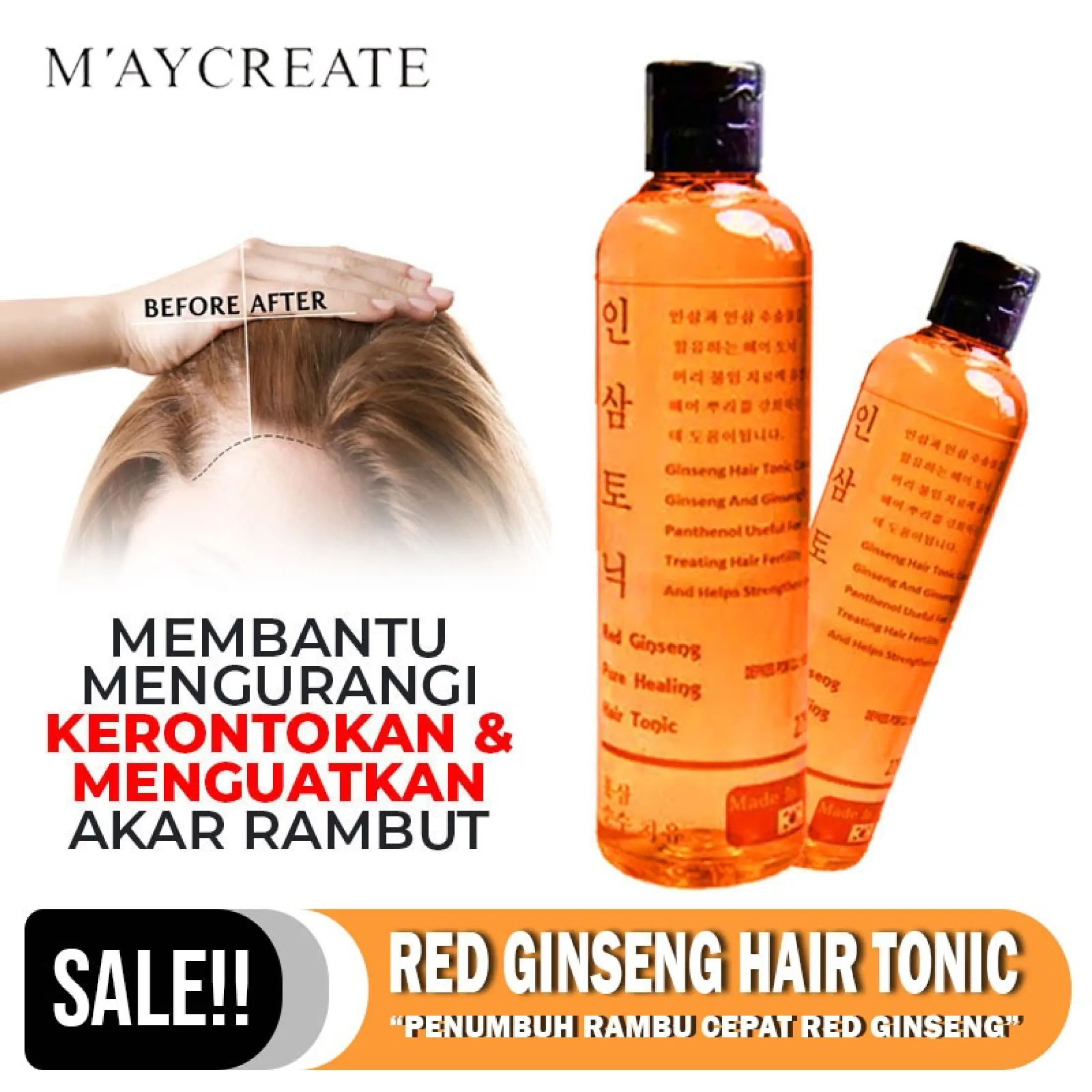 Penumbuh Rambut Permanen Dalam 3 Mengatasi Kebotakan Kuntze Minyak Kemiri Vitamin Rambut Rontok Botak Red Ginseng Hair Tonic Obat Penumbuh Rambut Botak Obat Penyubur Rambut Penumbuh