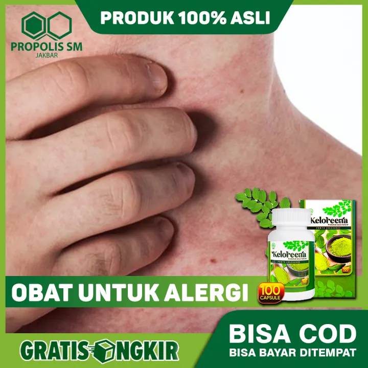 Cara Rawat Penyakit Ekzema