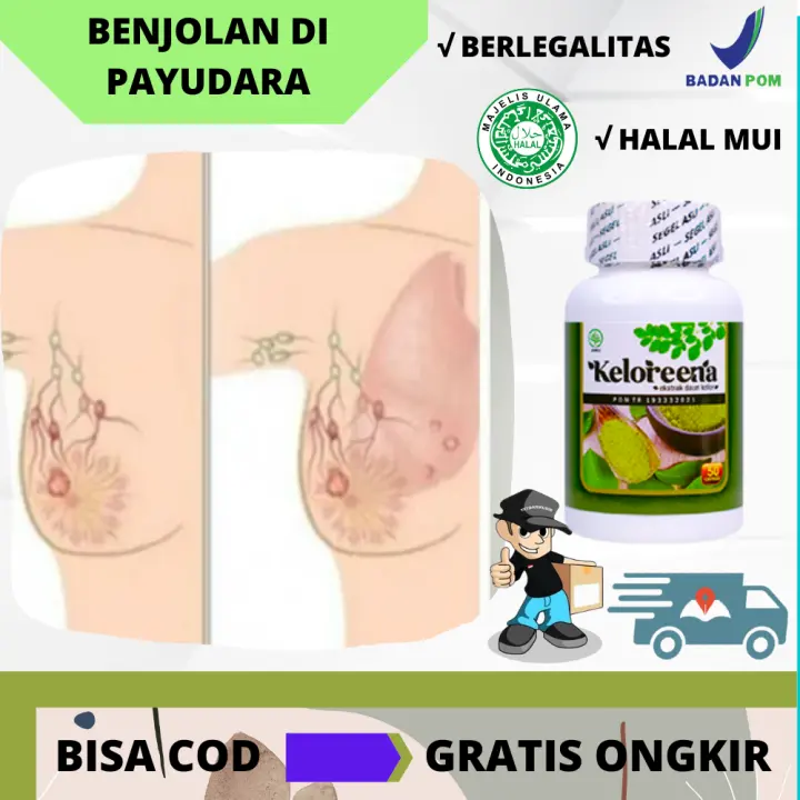 Obat Herbal Untuk Payudara Bengkak Suplemen Untuk Menghilangkan Kista Di Daerah Payudara Menghilangkan Kelenjar Lunak Keras