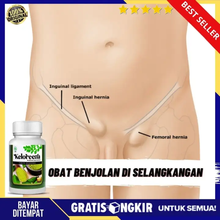 Obat Sekelan Di Selangkangan Alami Obat Buat Sakit Sekelan Obat Benjolan Di Ketiak Leher Tangan