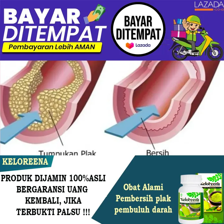 Obat Alami Untuk Menghancurkan Plak Pembuluh Darah Penghancur Pembersih Plak Di Pembuluh Darah Dengan Obat Herbal Alami Keloreena Lazada Indonesia