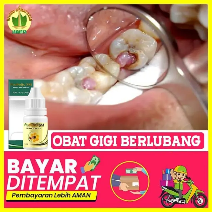 Obat Sakit Gigi Tetes Herbal Penghilang Sakit Gigi Gigi Berlubang Gigi Keropos Obat Sakit Gigi Berdenyut Sakit Gigi Lama Berhari Hari Sakit Gigi Gusi Bengkak Untuk Anak Dan Dewasa Aman Propolis Sm