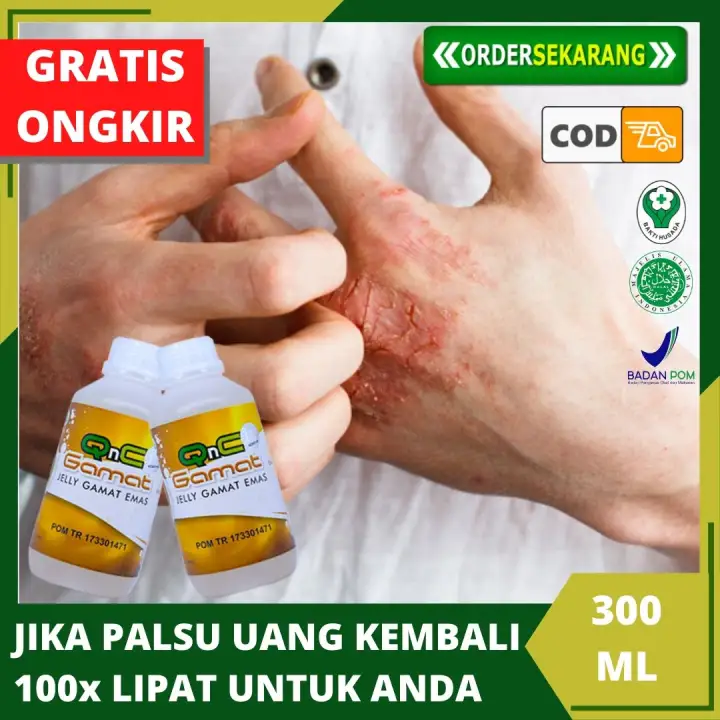Qnc Jelly Gamat Obat Eksim Kering Menahun Obat Herbal Gatal Exim Eksim Basah Obat Alergi Kulit