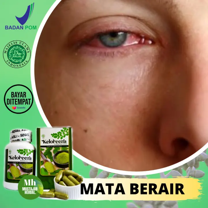 Obat Mata Berair Selalu Keluar Air Perih Dan Pedih Sakit Alergi Merah Pada Kornea Mata Vitamin