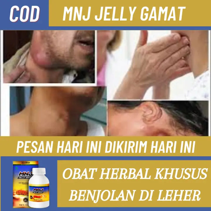 3 Cara Mengobati Benjolan Di Leher Kiri Dan Kanan