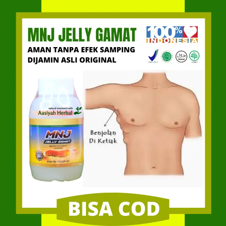 Obat Buat Benjolan Di Bawah Ketiak Obat Kelenjar Obat Benjolan Di Leher Obat Benjolan Belakang Telinga