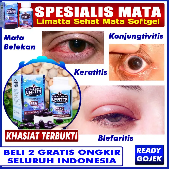 Obat Mata Belekan Blefaritis Peradangan Kelopak Mata Mata Merah Iritasi Gatal Dan Bengkak Konjungtivitis Radang Konjungtiva Mata Merah Berair Keratitis Radang Kornea Mata Limatta Sehat Mata Softgel Nanotechnology Lazada Indonesia