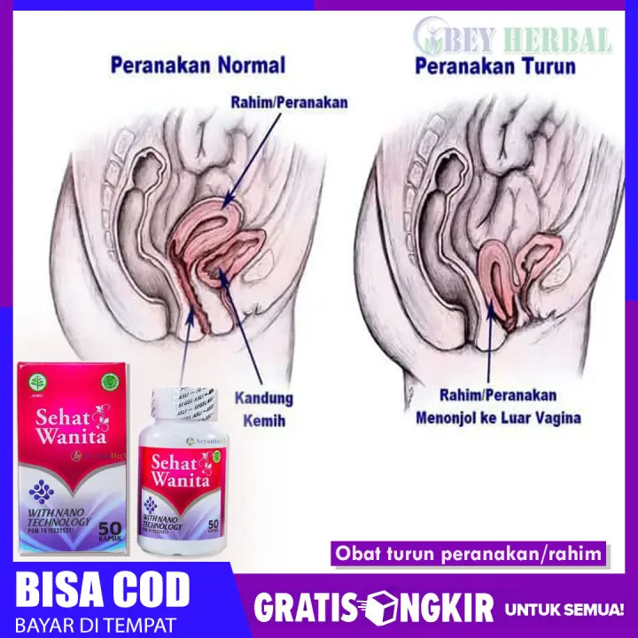 Obat Untuk Turun Peranakan Obat Turun Rahim Sehat Wanita Lazada Indonesia