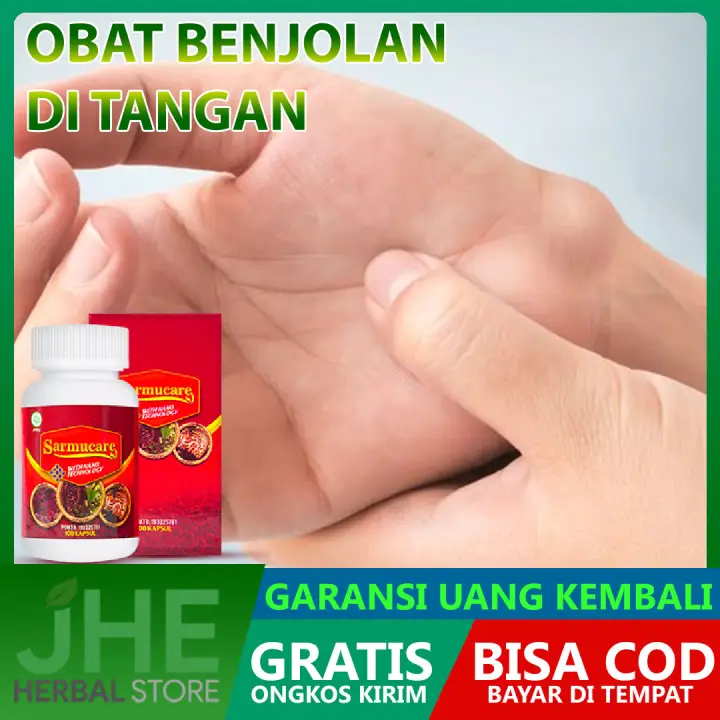 Obat Benjolan Di Tangan Kanan Dan Kiri Benjolan Di Siku Lengan Jari Telapak Tangan Benjolan Di Pergelangan Tangan Lazada Indonesia