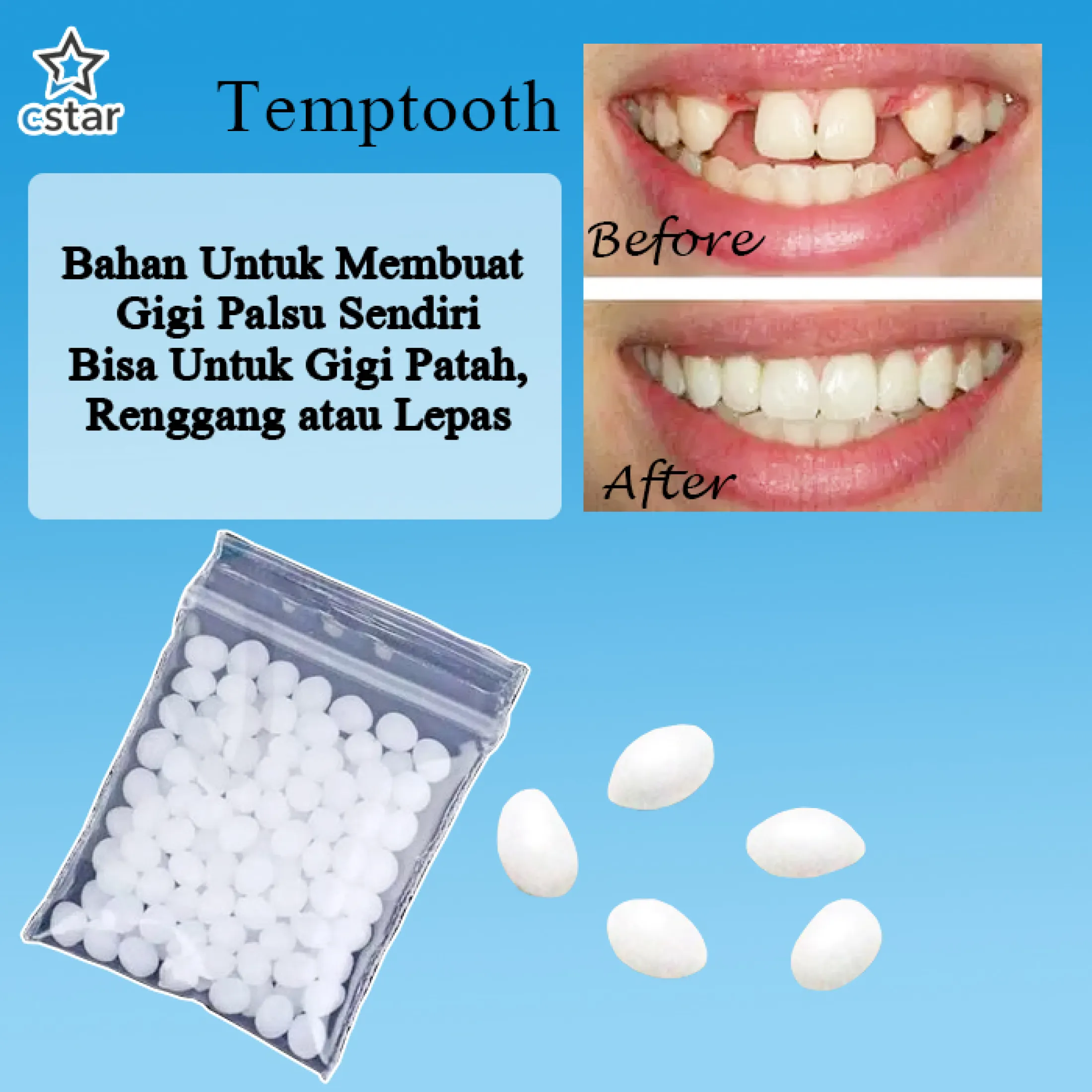 Bisa Termurah Temptooth Penambal Gigi Buat Gigi Palsu Sendiri 50 Butir Patahlepasrenggang Lazada Indonesia