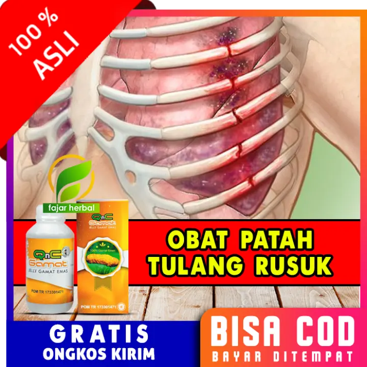 Obat Patah Tulang Iga Bpom Mengobati Nyeri Rusuk Parah Retak Bagian Kiri Dan Kanan Kronis Herbal Lazada Indonesia