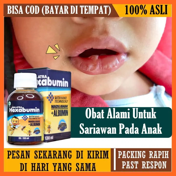 Obat Alami Untuk Sariawan Obat Sariawan Untuk Anak Kecil Balita 1 2 3 4 5 Tahun