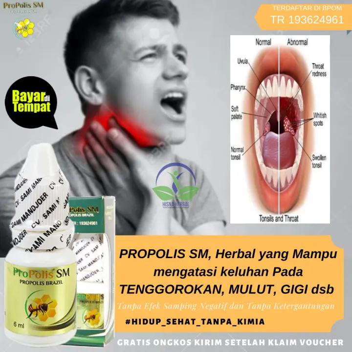 Obat Sakit Gigi Untuk Anak Dan Dewasa Sakit Gigi Berlubang Ngilu Sensitif Bengkak Goyang Gusi Bengkak Sariawan Penghilang Polip Di Gigi Geraham Bolong Bengkak Kumur Bau Mulut Menghilangkan Karang Gigi Pemutih Pembersih