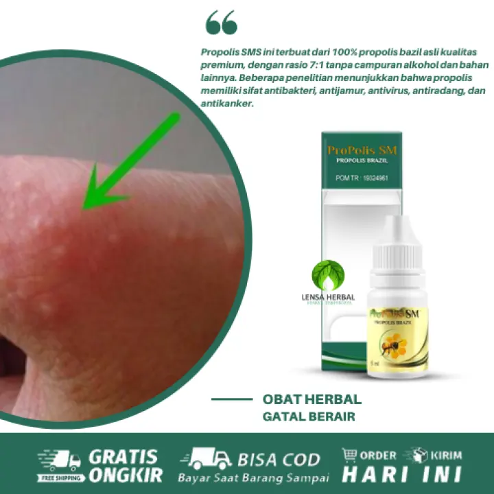 Obat Alami Gatal Berair Dan Menyebar Obat Gatal Berair Bernanah Obat Gatal Bintik Berair Di Tangan