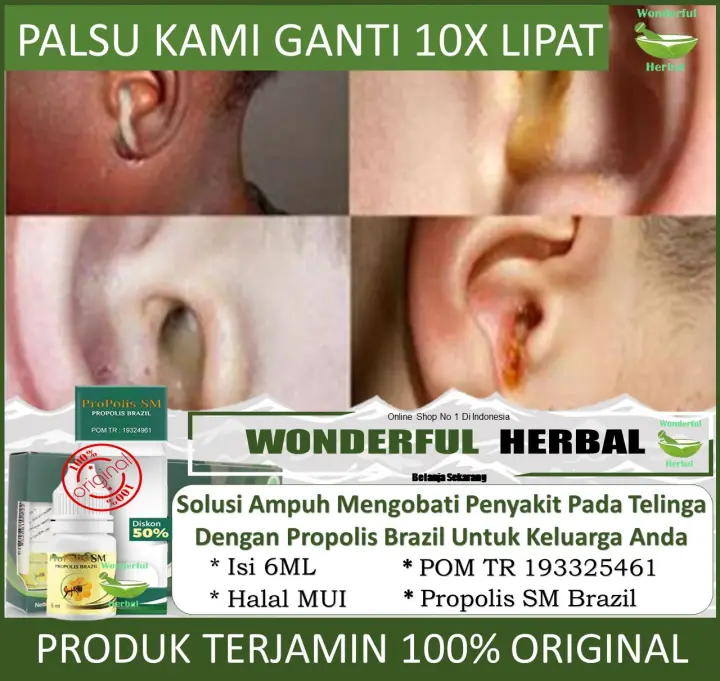 Obat Telinga Berair Dan Bau Telinga Bernanah Telinga Keluar Cairan Bau Obat Congek Curek Infeksi Telinga