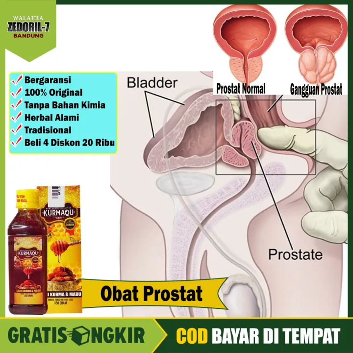 Obat Prostat Obat Gangguan Prostat Obat Benjolan Prostat Obat Bengkak Prostat Obat Infeksi Saluran Kencing Obat Sakit Kencing Obat Memperlancar Kencing Obat Prostat Bengkak Kurmaqu 100 Asli Aman Di Konsumsi Lazada Indonesia