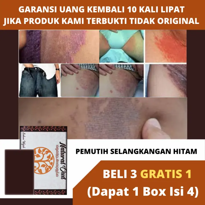 Sabun Natural Oud Obat Untuk Memutihkan Selangkangan Hitam Selangkangan Gelap Selangkangan Sangat Hitam Kulit Selangkangan Sangat Hitam Kulit Selangkangan Kasar Kulit Selangkangan Hitam Gelap Gatal Gatal Selangkangan 100 Tanpa Kimia Sabun Natural Oud Obat Untuk Memutihkan Selangkangan Hitam Selangkangan Gelap Selangkangan Sangat Hitam Kulit Selangkangan Sangat Hitam Kulit Selangkangan Kasar Kulit Selangkangan Hitam Gelap Gatal Gatal Selangkangan 100 Tanpa Kimia
