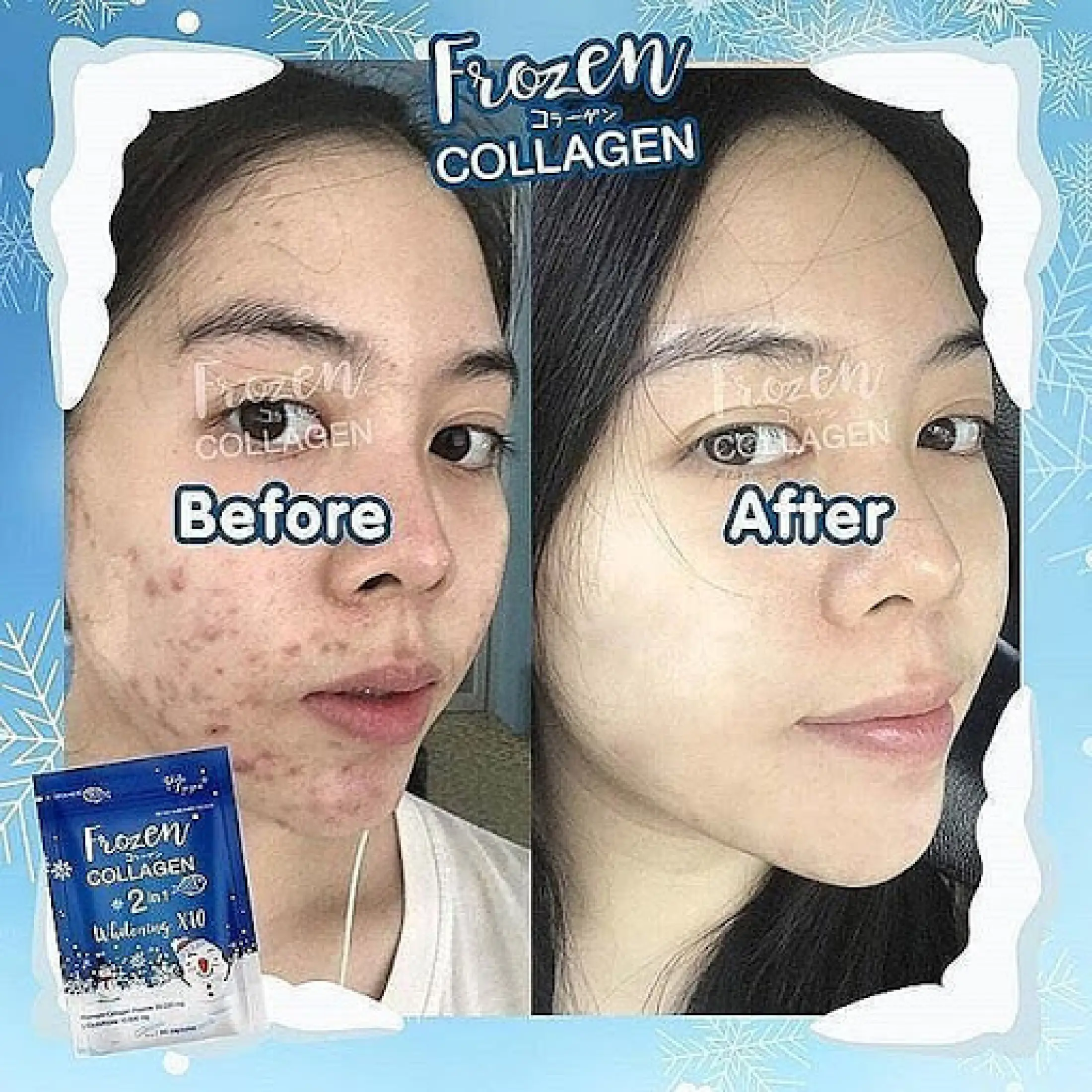 Gluta Frozen Collagen 2in1 Whitening 10x Original Aman Dan Halal Isi 60 Kapsul Lazada Indonesia