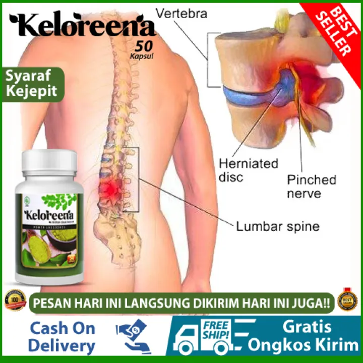 Obat Saraf Terjepit Saraf Terhimpit Saraf Sakit Saraf Kejepit Di Leher Punggung Tangan Kaki Nyeri Lengan