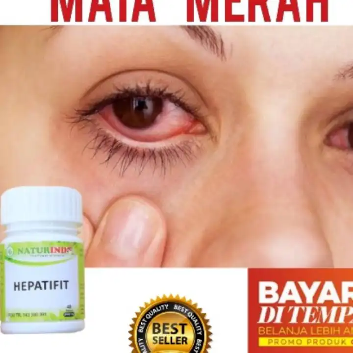 Obat Hebal Mata Merah Panas Mata Kering Mata Terasa Berpasir Berair Penglihatan Buram Lazada Indonesia