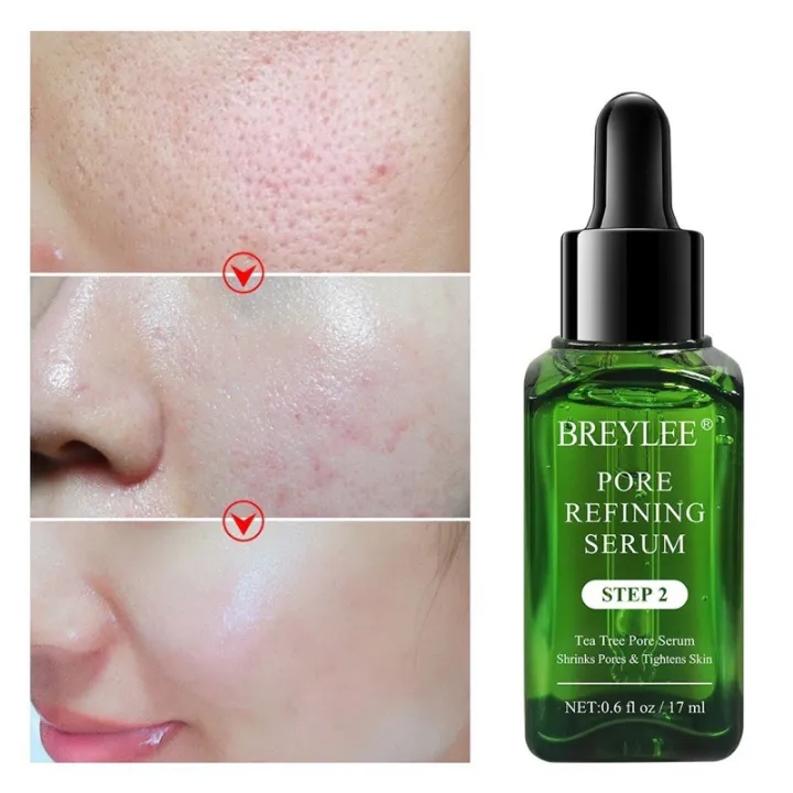 Breylee Step 2 Serum Wajah Pengecil Pori Pori Ampuh Murah Bpom Original Membuat Kulit Wajah Halus Dan Lemut Mengecilkan Pori Besar Lazada Indonesia