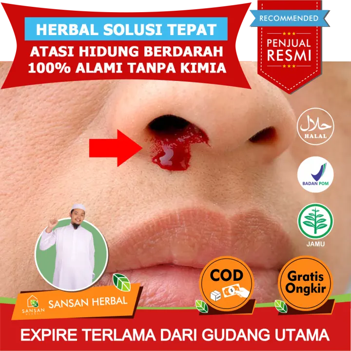 Hidung Berdarah Sedikit