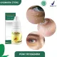 Obat milia di area mata, Milia pada wajah, milia di bawah mata, Obat milia Bpom, milia untuk anak, milia di kelopak mata, Obat bintik kecil di mata, Brutusan di area mata, penghilang milia Propolis SM Herbal Berkualitas. 